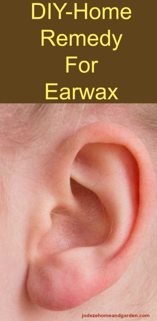 DIY Home Remedies - DIY-Home Remedy For Earwax - Homemade Recipes and Ideas for Help Relieve Symptoms of Cold and Flu, Upset Stomach, Rash, Cough, Sore Throat, Headache and Illness - Skincare Products, Balms, Lotions and Teas 