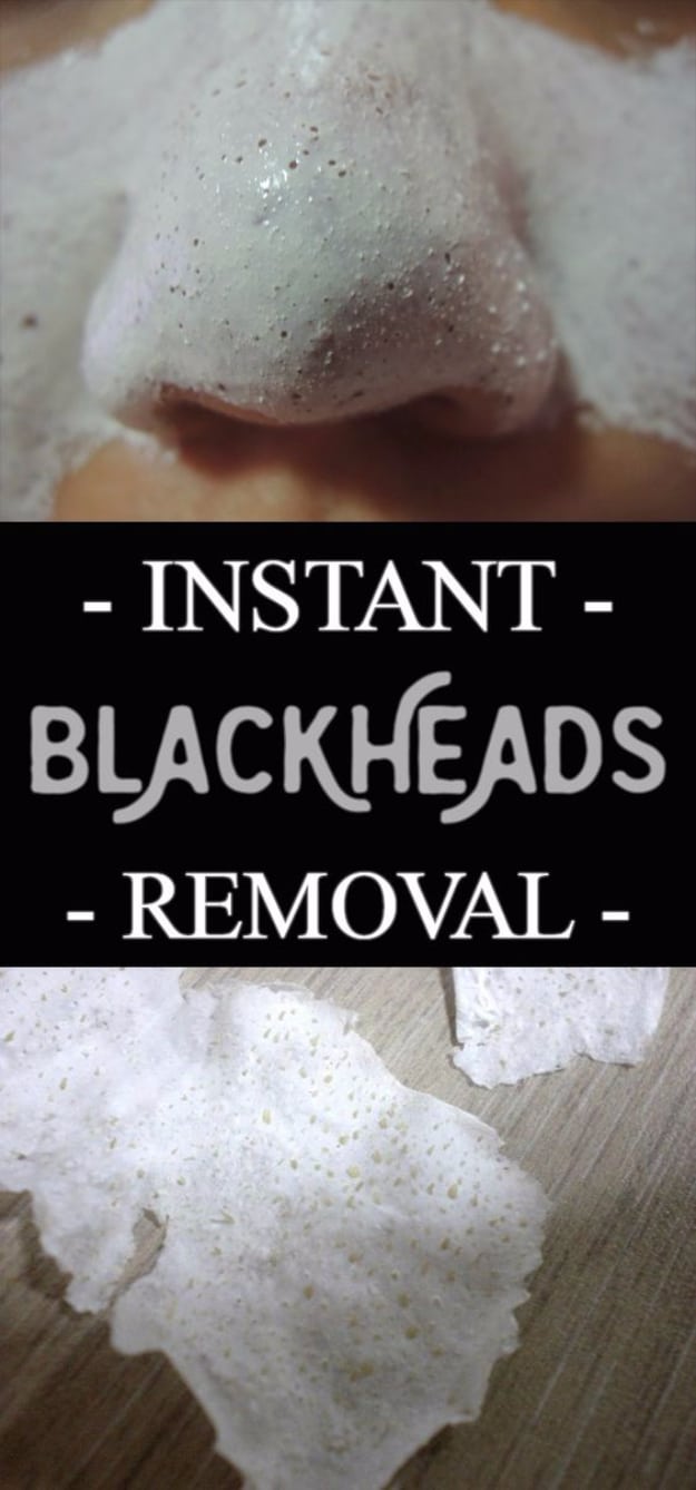 DIY Beauty Hacks - Instant Blackheads Removal - Cool Tips for Makeup, Hair and Nails - Step by Step Tutorials for Fixing Broken Makeup, Eye Shadow, Mascara, Foundation - Quick Beauty Ideas for Best Looks in A Hurry #beautyhacks #makeup