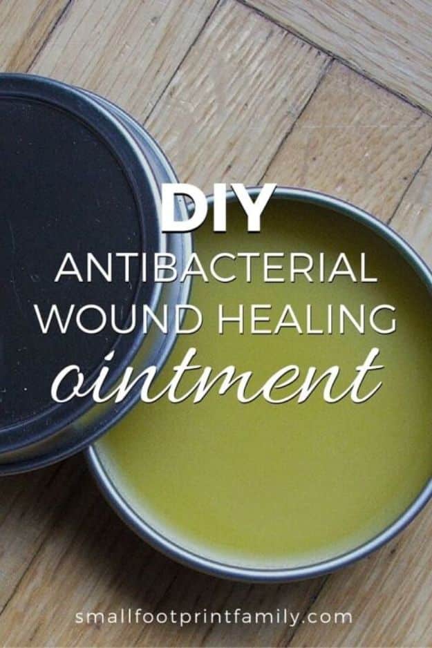 DIY Home Remedies - DIY Wound Healing Ointment - Homemade Recipes and Ideas for Help Relieve Symptoms of Cold and Flu, Upset Stomach, Rash, Cough, Sore Throat, Headache and Illness - Skincare Products, Balms, Lotions and Teas 