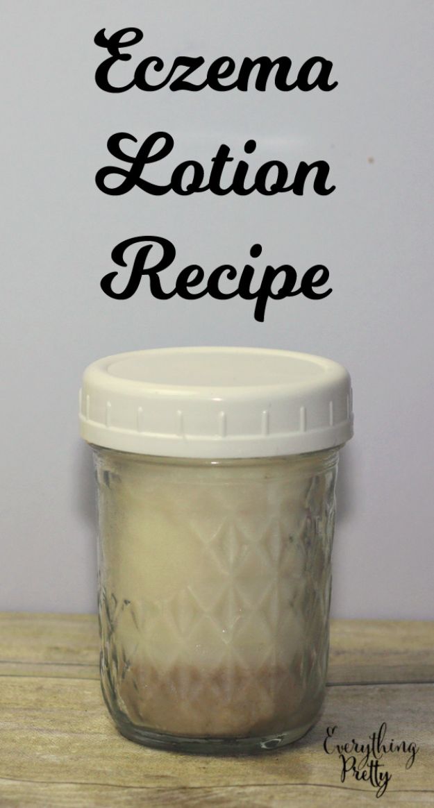 DIY Lotion Recipes - DIY Eczema Lotion - How To Make Homemade Lotion - Natural Body and Skincare Recipe Ideas - Use Essential Oils, Coconut and Avocado and Shea Butter, Goats Milk, Lavender, Peppermint 