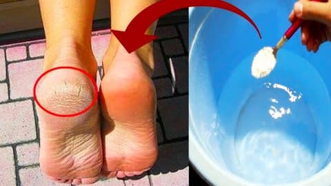 How To Get Rid Of Cracked Heels | DIY Joy Projects and Crafts Ideas