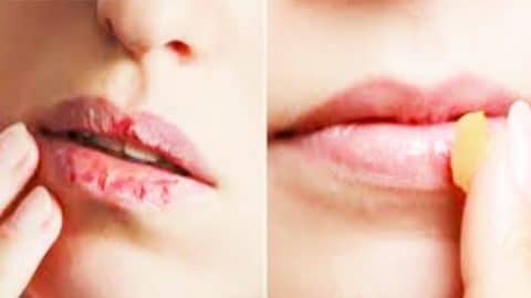 Home Remedies To Get Rid Of Chapped Lips | DIY Joy Projects and Crafts Ideas