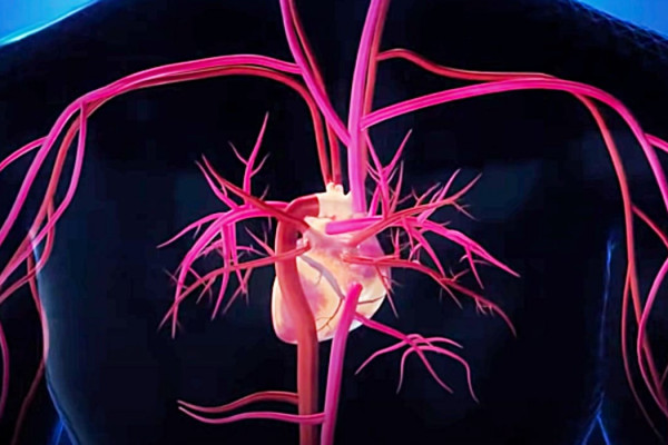 Foods That Help Clean Arteries - Easy Way To Clean Arteries - Clean Arteries Naturally __ Healthy Food Ideas