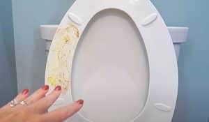 Remove Yellow Stains From The Toilet Seat And Lid