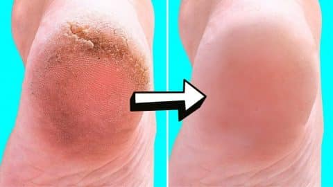 10 Natural Home Remedies For Silky Smooth Feet | DIY Joy Projects and Crafts Ideas