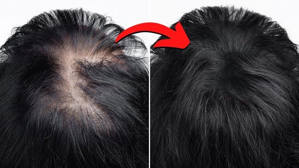 6 Ways To Thicken Your Hair In A Week
