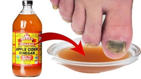 Easy And Cheap Toenail Fungus Treatment | DIY Joy Projects and Crafts Ideas