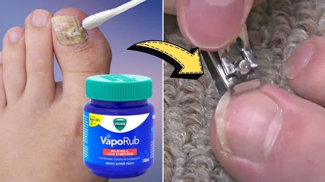 Home Remedy for Clean White Nails - The Repo Woman