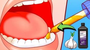 5 Ways To Relieve A Toothache In 1 Minute