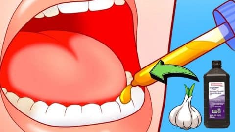 5 Ways To Relieve A Toothache In 1 Minute | DIY Joy Projects and Crafts Ideas