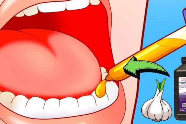 5 Ways To Relieve A Toothache In 1 Minute