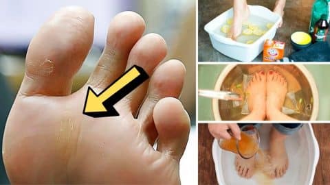 How To Get Rid Of Foot Odor For Good | DIY Joy Projects and Crafts Ideas