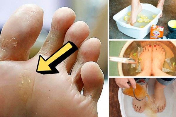 How To Get Rid Of Foot Odor For Good