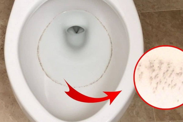 3 Effective Solutions For Recurring Toilet Ring