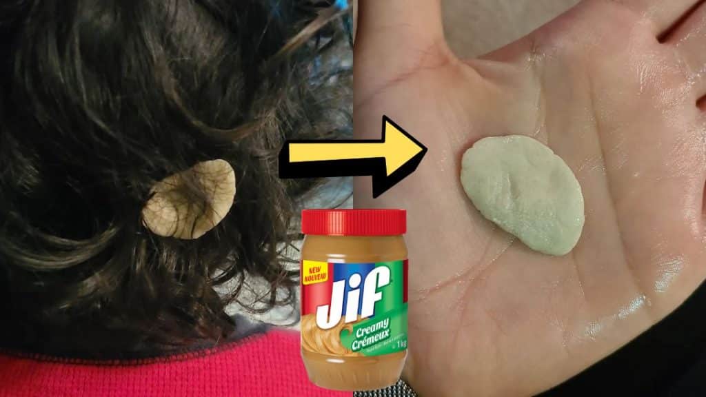 How To Remove Gum Without Cutting Hair