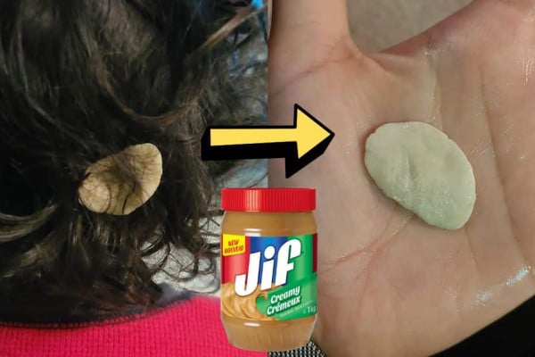 How To Remove Gum Without Cutting Hair