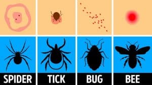 How To Identify & Treat A Bug Bite
