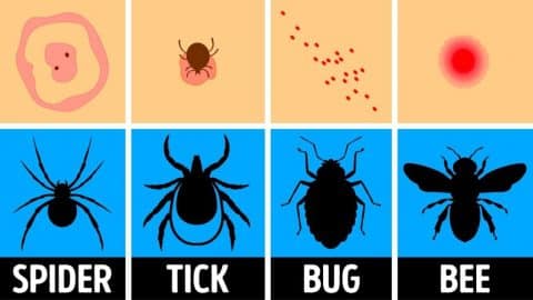 How To Identify & Treat A Bug Bite | DIY Joy Projects and Crafts Ideas