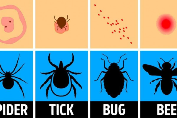 How To Identify A Bug Bite & What To Do With It