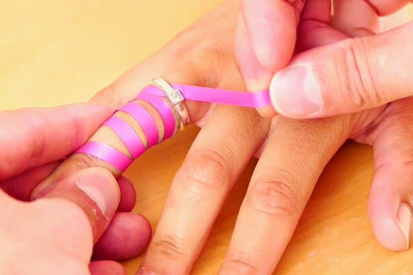 How To Remove Stuck Ring From Finger Easily