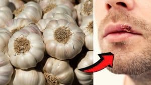 7 Amazing Benefits Of Garlic During The Winter