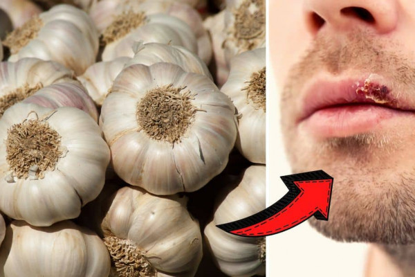 7 Amazing Benefits Of Garlic During The Winter