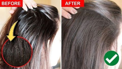 How To Fix Greasy Hair Naturally | DIY Joy Projects and Crafts Ideas