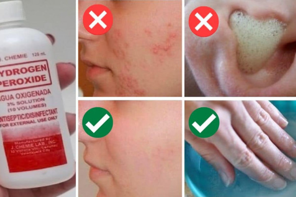 5 Surprising Uses for Hydrogen Peroxide