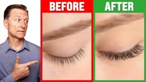 How To Grow Long Thick Eyelashes Quickly