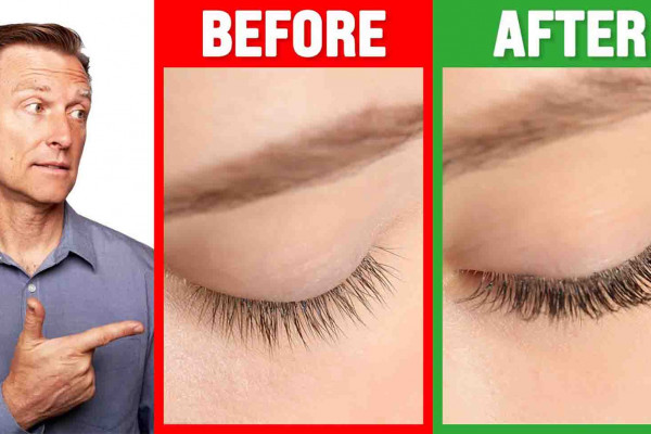 How To Grow Long Thick Eyelashes Quickly
