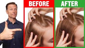 How To Grow Thin Hair Into Thick Hair
