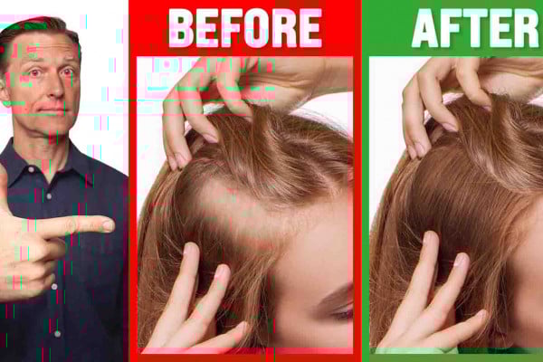How To Grow Thin Hair Into Thick Hair