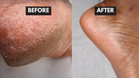 How to Remove Dead Skin Cells From Your Feet in Minutes | DIY Joy Projects and Crafts Ideas