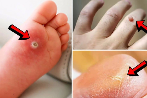 4 Surprising Uses & Benefits of Castor Oil