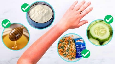 7 Instant Relief Remedies for Sunburn | DIY Joy Projects and Crafts Ideas