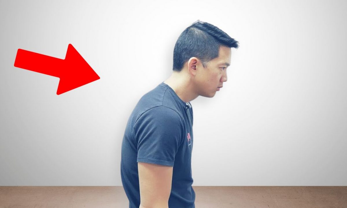 How to Fix Hunchback Posture in 3 Minutes