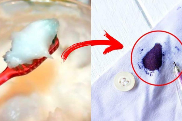 Simple Way to Remove Ballpoint Ink From Clothes