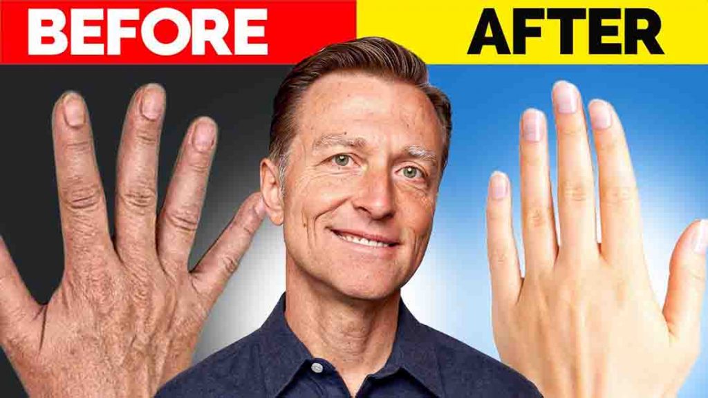 DIY Homemade Remedy for Wrinkled Hands