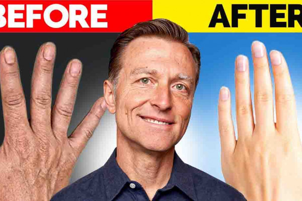 DIY Homemade Remedy for Wrinkled Hands