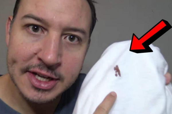How To Remove Blood Stains From Clothes