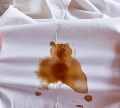 How to Remove Clothes Stain Using Baking Soda - DIY Joy