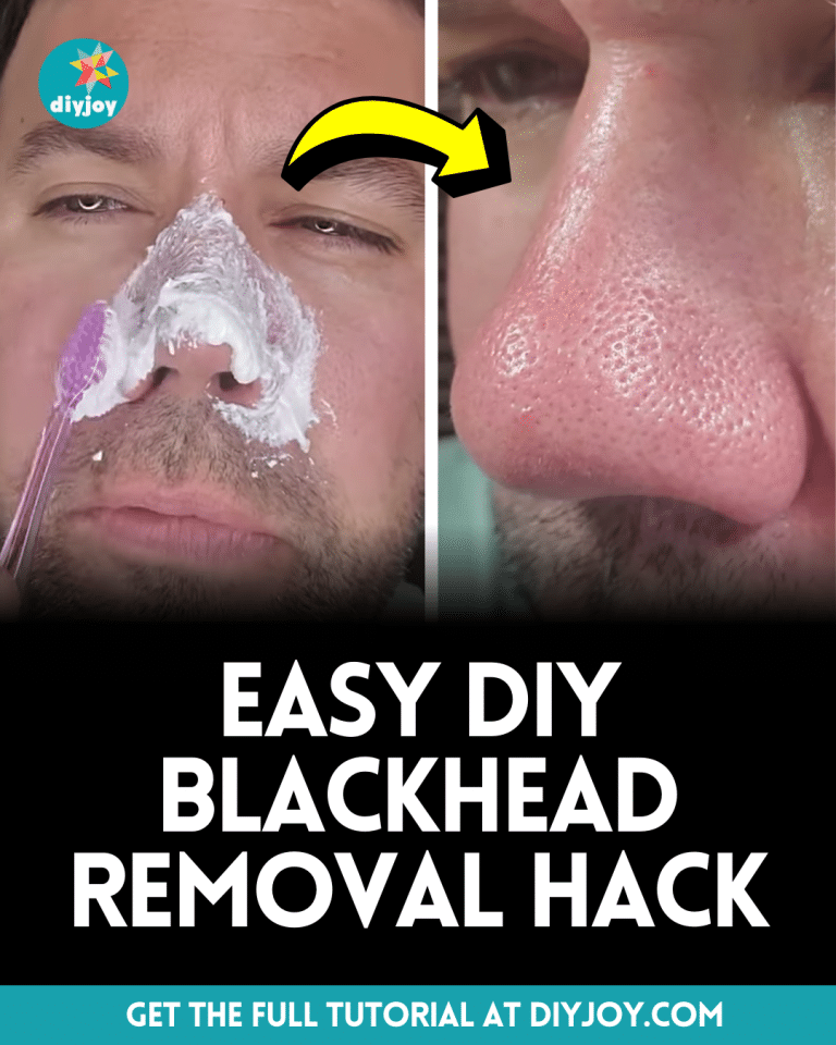 Easy DIY Blackhead Removal Hack DIY Joy