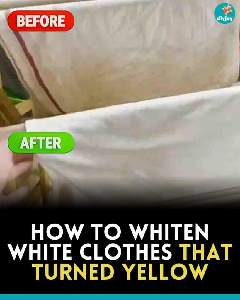 How To Whiten White Clothes That Turned Yellow