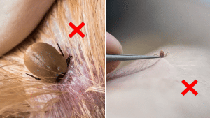 How to Remove Ticks Safely