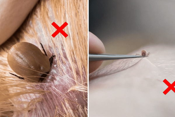 How to Remove Ticks Safely