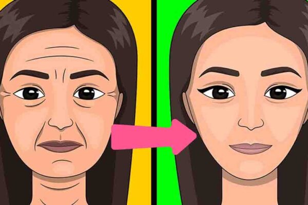 5 Ways To Get Rid of Wrinkles and Fine Lines Naturally
