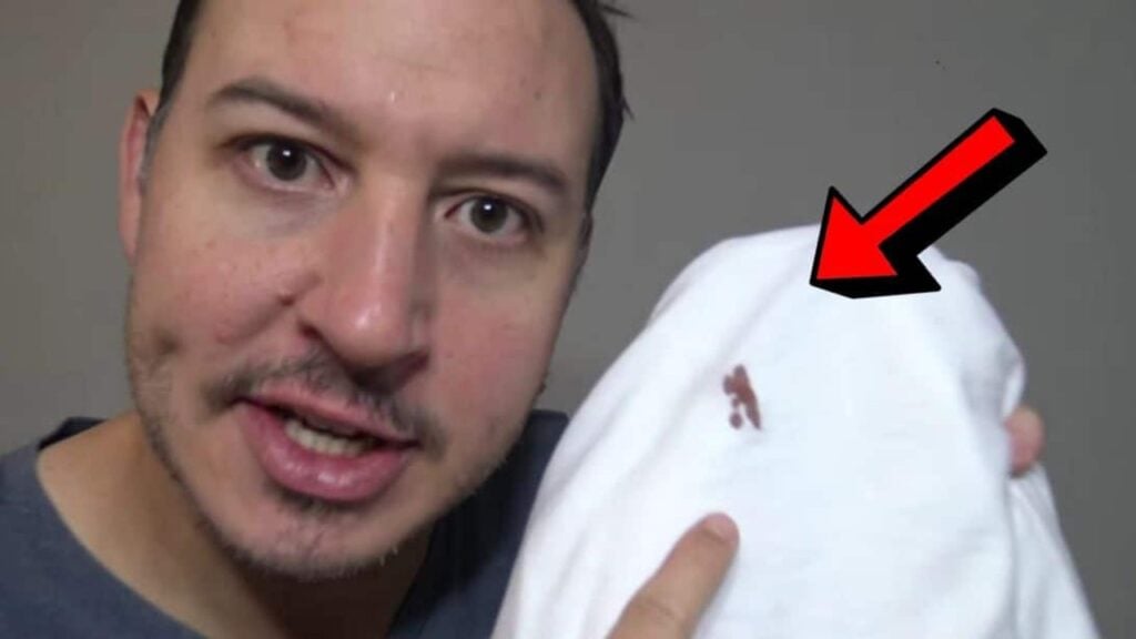 How To Remove Blood Stains From Clothes