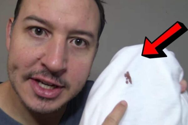 How To Remove Blood Stains From Clothes