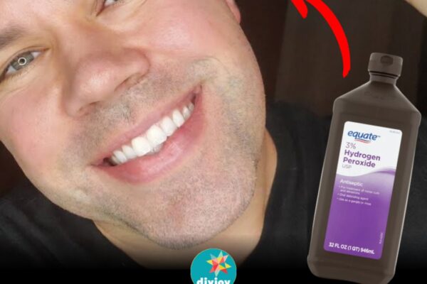 How to Remove Earwax Safely at Home