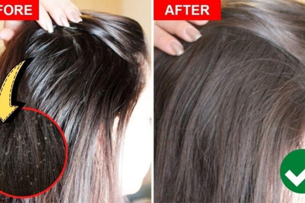 Finished How To Fix Greasy Hair Naturally, a completed DIY project
